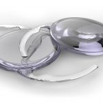 concept illustration of 2 intraocular lenses (IOLs)