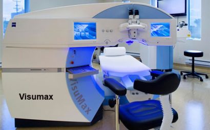 photo of a visumax cataract surgery treatment setup