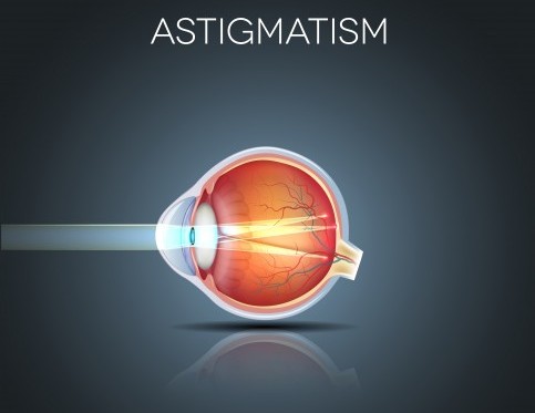 Ce fel de viziune cu astigmatism