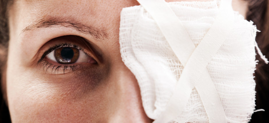 female eye injury patient with a bandage covering her left eye