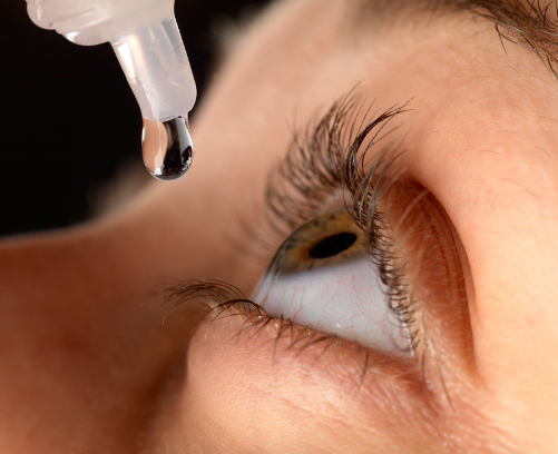 4 Types of Eye Drops and How to Safely Put Them In