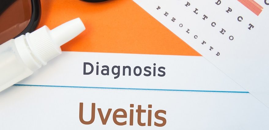 glasses, eyedrops and an eye chart rest on a sheet labeled diagnosis uveitis
