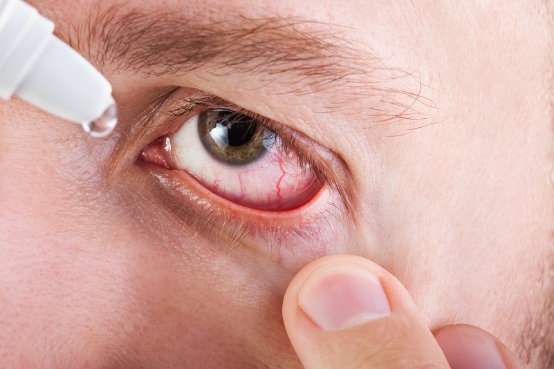 Treating Dry Eye Before Cataract Surgery (& LASIK) Better Vision Guide